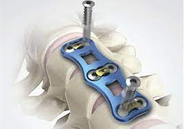 Передня шийна пластина, виробник Jinlu